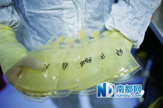 <p>    經(jīng)過培養(yǎng)的細(xì)胞液最終要回輸?shù)交颊唧w內(nèi)。</p>