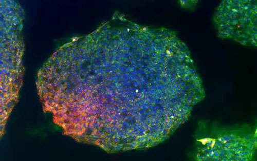 2014你不能錯(cuò)過(guò)的干細(xì)胞論文！  