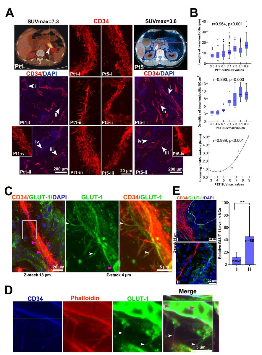 復(fù)旦大學(xué)揭開＂癌癥之王＂內(nèi)的神秘運(yùn)輸通道